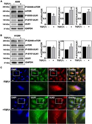 Canonical and Non-canonical TGFβ Signaling Activate Autophagy in an ULK1-Dependent Manner